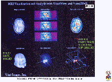 DvC2-01_SEG102